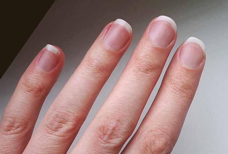 Лунулы. Широкие ногти. Ногти плоские и широкие. Нормальные ногти. Широкая ногтевая пластина.